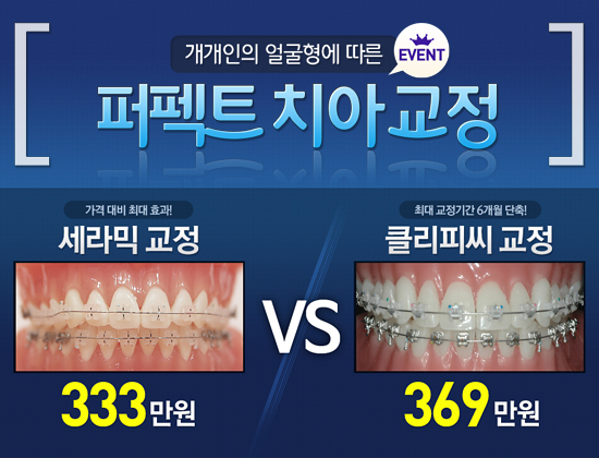 �������� ������ ���� ����Ʈ ġ�Ʊ���, ����ͱ��� 333����, Ŭ���Ǿ����� 369����