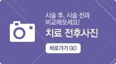 �ü���, �ü����� ���� ������! ġ�����Ļ��� �ٷΰ��� go