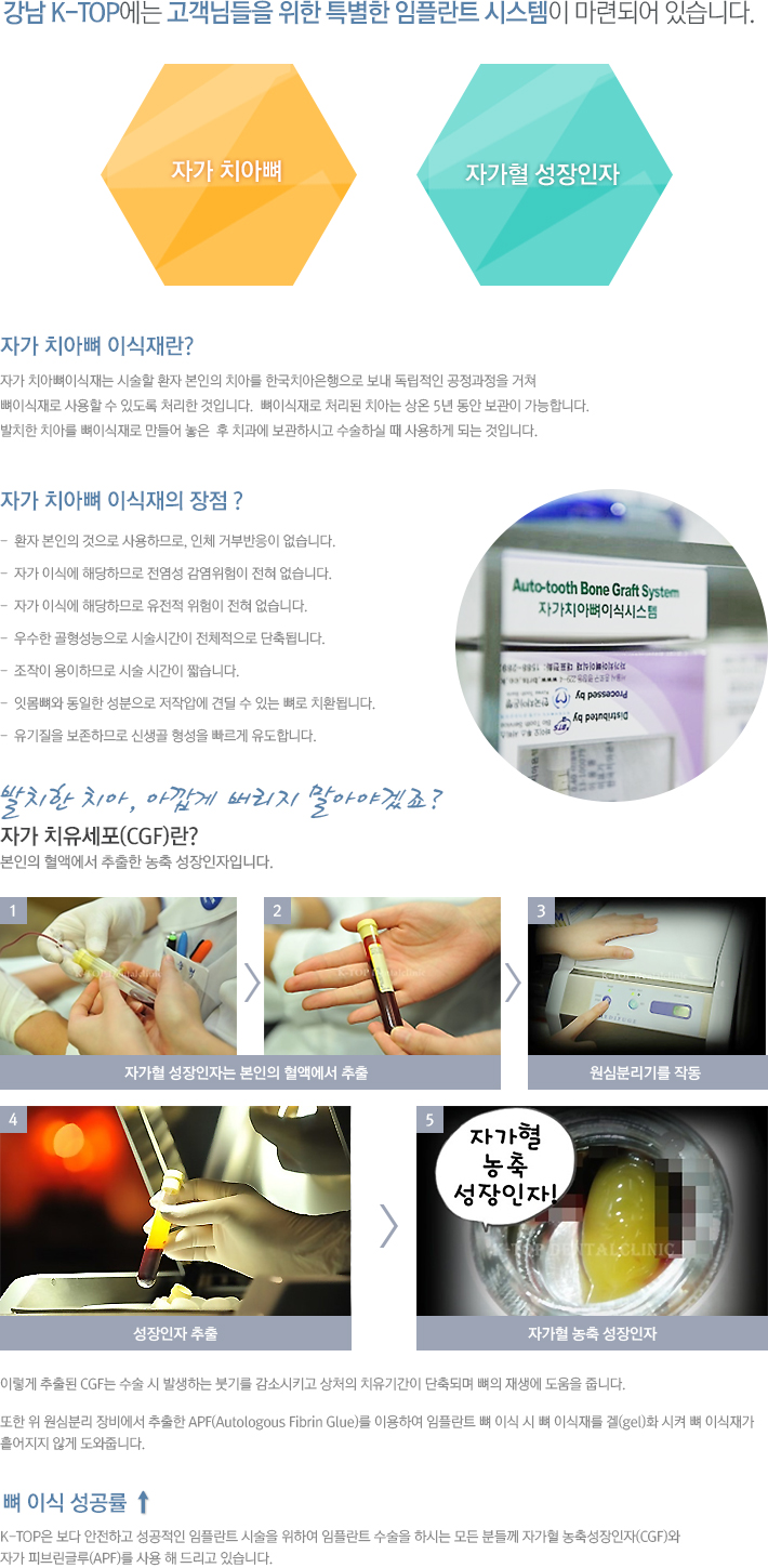 �ڰ��� ���ö�Ʈ