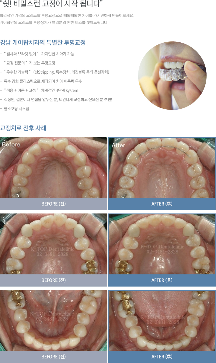 ũ����Ż ��������