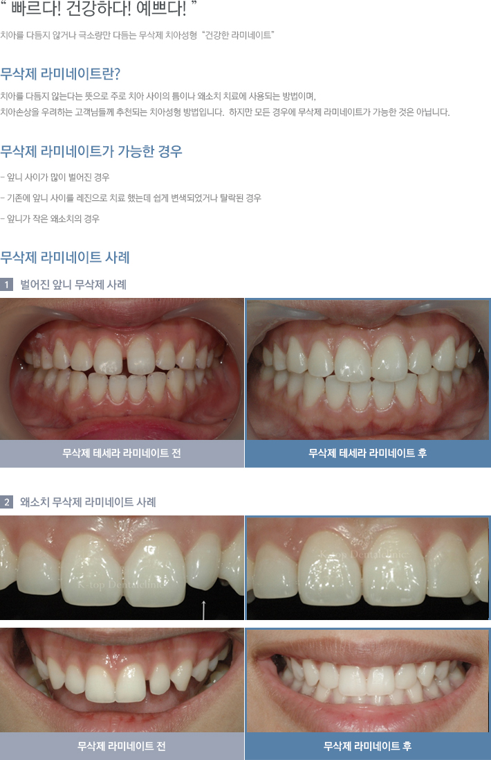 ������ ��̳���Ʈ