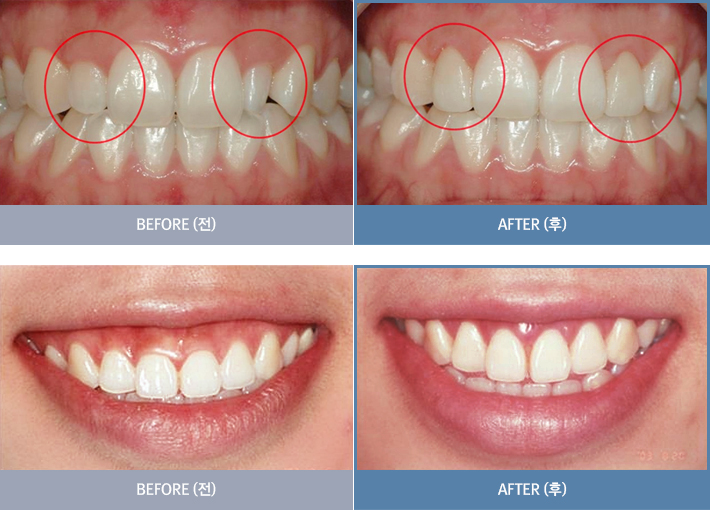 ġ�����Ļ���