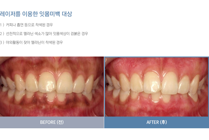 ġ�����Ļ���