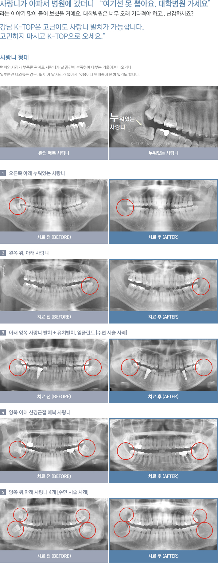 ����� ��ġ