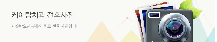 ����ž ġ�� ���Ļ��� �ü� ������ �е��� ġ�� ���� �����Դϴ�.